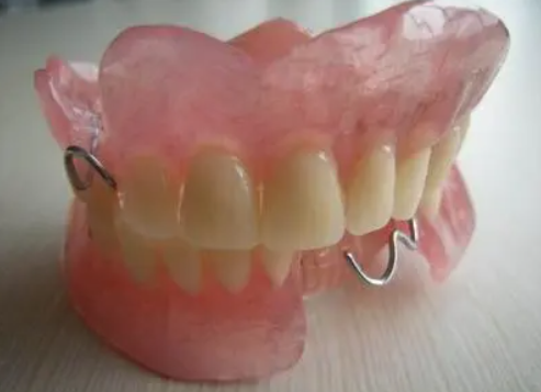 局部义齿修复介绍以及修复过程?