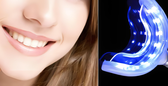 最新的牙齿美容技术有哪些？