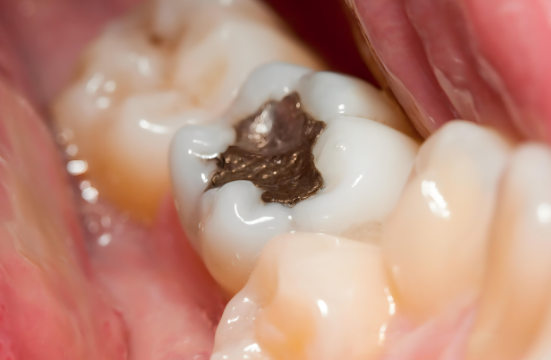 牙齿健康与生活方式的关系是什么？