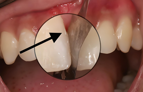 如何应对牙齿敏感引起的不适？