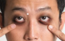 黑眼圈很重对身体有什么影响? 