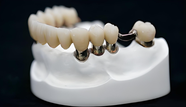局部义齿修复手术方法有哪些？